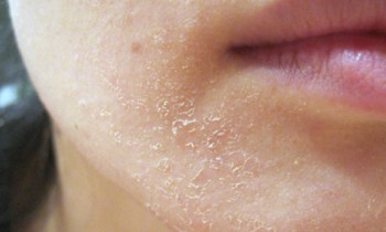 5 - Da bạn thuộc loại nào?